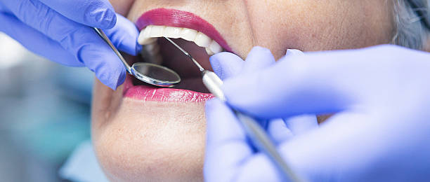 Best Emergency Dental Care for Broken or Chipped Teeth in New Stanton, PA